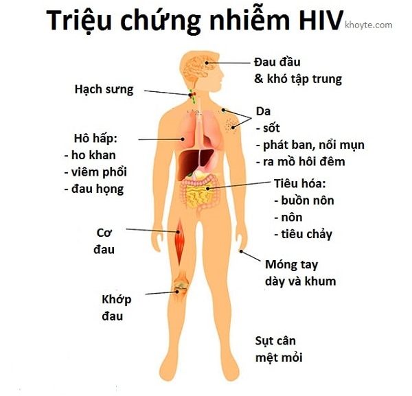 Các triệu chứng của HIV được biểu hiện như thế nào?